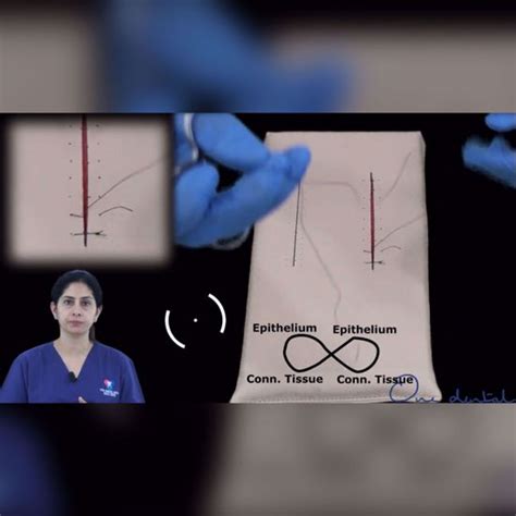 Figure of eight suture demonstration-One Dental is the Biggest online ...