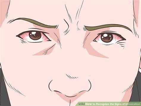 Image result for Signs of Intoxication