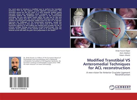 Modified Transtibial VS Anteromedial Techniques for ACL reconstruction ...