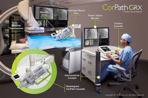 西门子医疗收购手术机器人公司Corindus