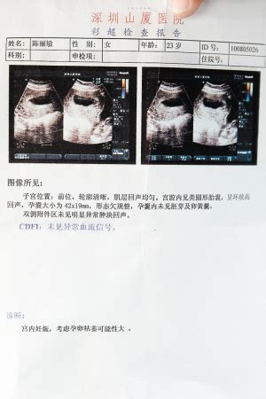 女子怀二胎36周查出凶险型前置胎盘 怀二孩要当心