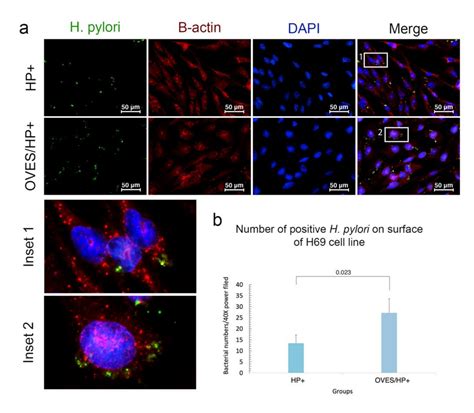 Biliary Migration, Colonization, and Pathogenesis of O. viverrini Co ...