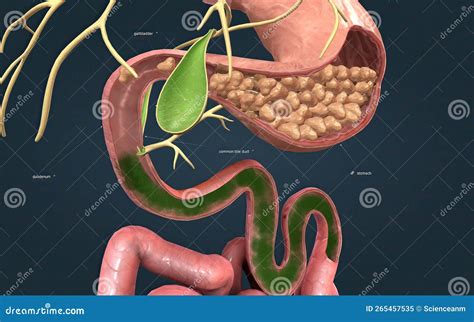 A Tube that Carries Bile from the Liver and Gallbladder, through the Pancreas, and into the ...