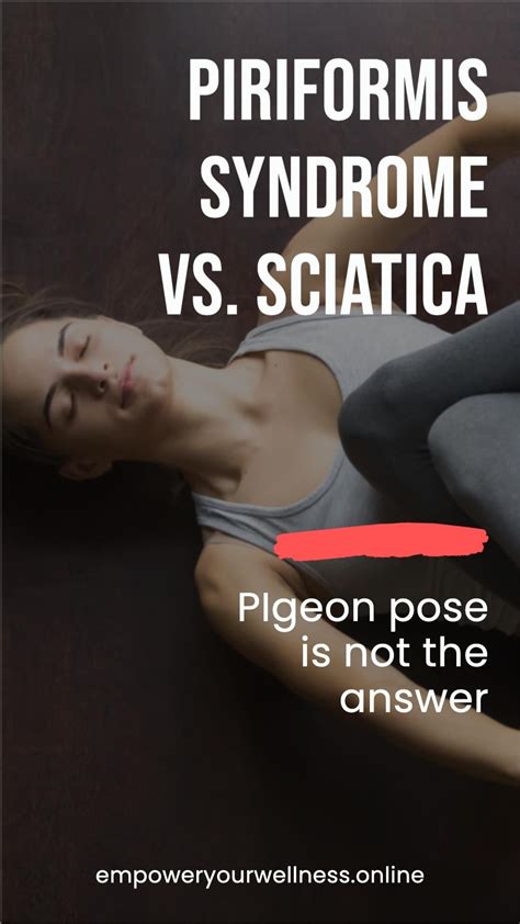 Piriformis syndrome vs sciatica what to know – Artofit