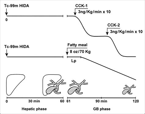 Comparison of Fatty Meal and Intravenous Cholecystokinin Infusion for Gallbladder Ejection ...