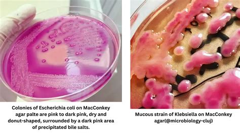 Klebsiella Pneumoniae Em Agar Macconkey The Origin Of MacConkey Agar - species of klebsiella
