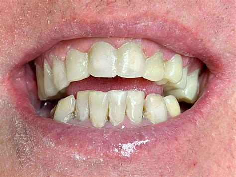 Colorado Springs Dentist | Tuttle Family Dentistry