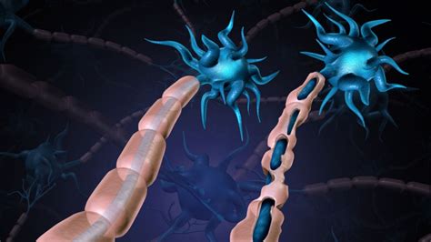 Peripheral Nerve Injury Treatment - Propel Physiotherapy