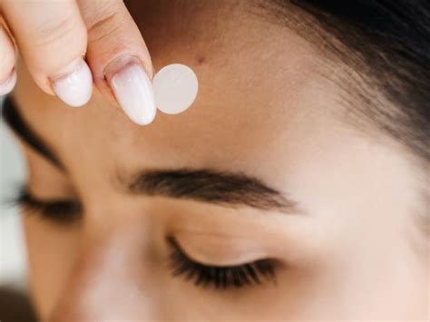 Scientists Just Discovered a Pimple Patch That May Work Better Than Most Acne Creams