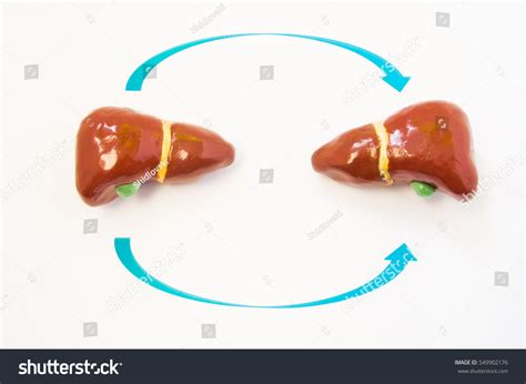 747 Transplant Oncology Images, Stock Photos & Vectors | Shutterstock