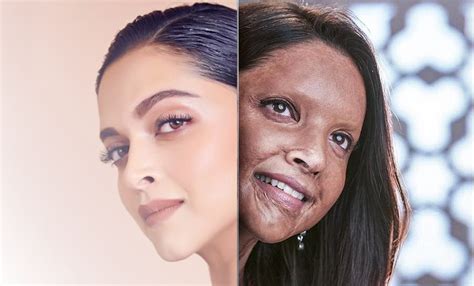 Deepika Padukone's First Look From 'Chhapaak' Reveals a Major ...