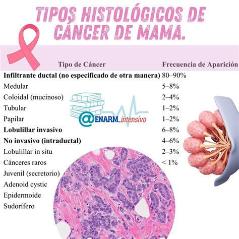 Subtipos patológicos del cáncer de mama - Homo medicus