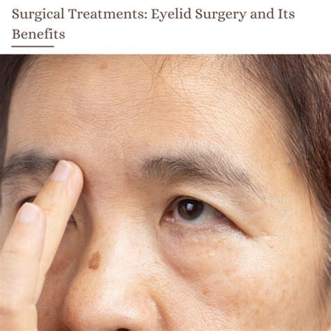 Droopy Eyelids (Ptosis): Causes, Treatments | Clinikally
