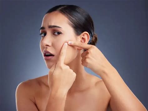 Skin sensitivity - Chai lovers, beware: Skin consequences of excessive ...