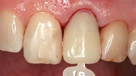 „Nichts ist so beständig wie das Provisorium“ | Quintessenz Verlags-GmbH