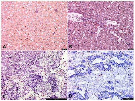 Developmental Parallels Between the Human Organs of Zuckerkandl and ...