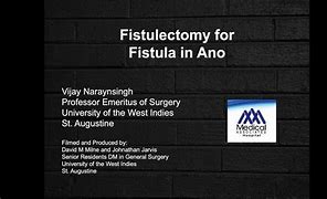 Image result for fistulectomy