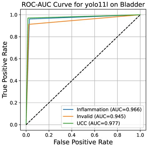 Explainable Computational Imaging for Precision Oncology: An ...