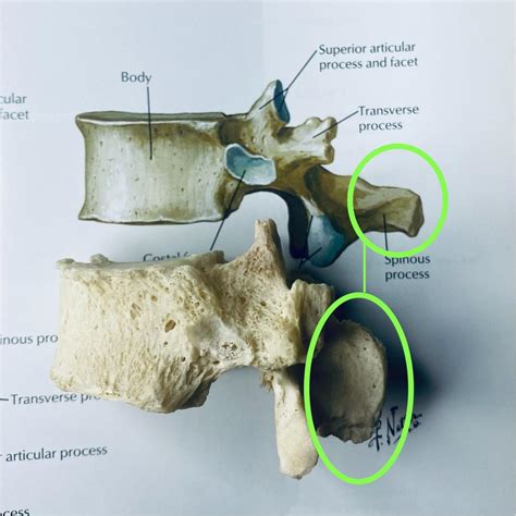 Inferior Articular Process