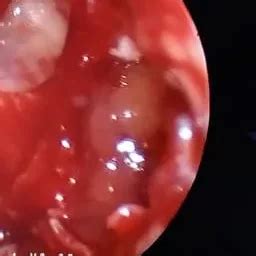 AuthENTic EAR NOSE THROAT HEAD & NECK CENTRE - Otolaryngologist ...