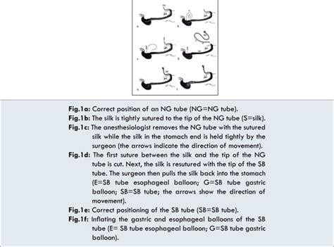 Successful Intraoperative Resuscitation following Upper ...