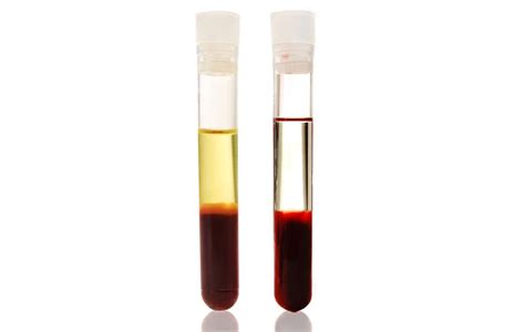 PRF Protocol 的图像结果