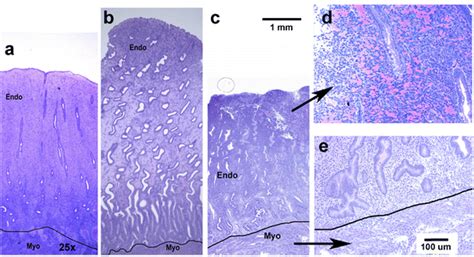 Uterus Endometrium Histology (Phases) Diagram | Quizlet