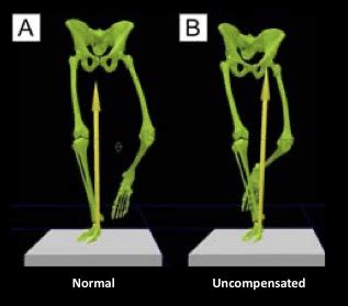 Image result for Contralateral Gait