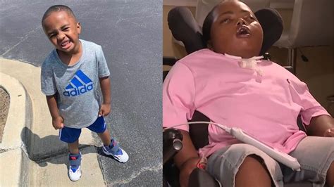 Metro Atlanta boy chokes on grape, suffers severe brain injury | 11alive.com