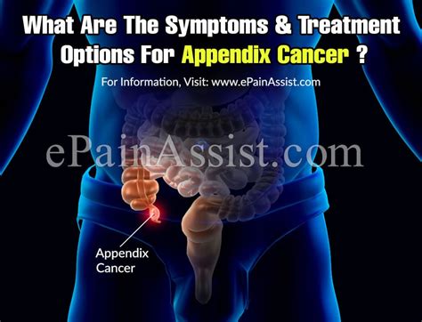 Image result for Appendix Cancer Symptoms