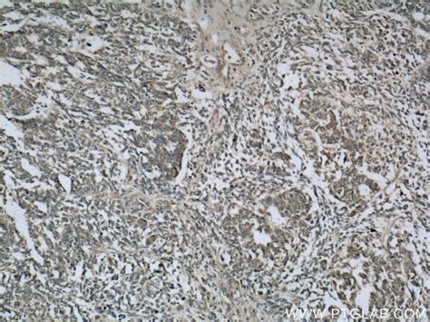 Cytokeratin 18 antibody (18708-1-AP) | Proteintech