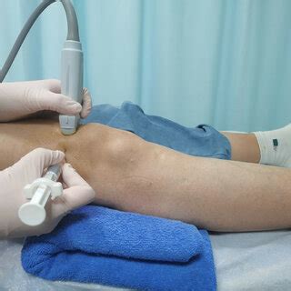 Injection Therapy 的图像结果
