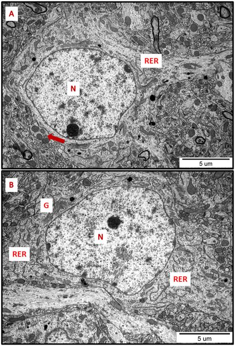 Endoplasmic Reticulum Stress Underlies Nanosilver-Induced Neurotoxicity ...