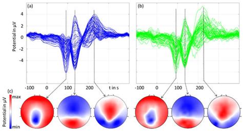 Simultaneous Dry and Gel-Based High-Density Electroencephalography ...