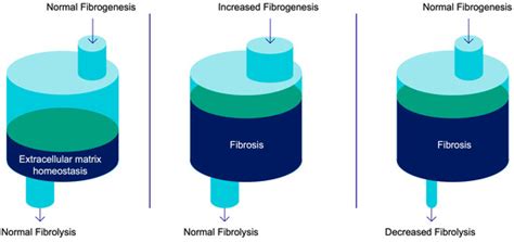 Radiotracers for Imaging of Fibrosis: Advances during the Last Two ...
