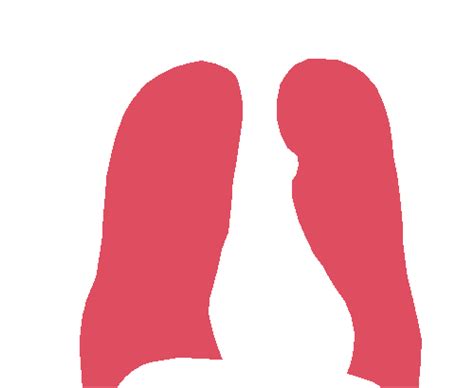 Chest Xray Masks and Labels - Dataset Ninja