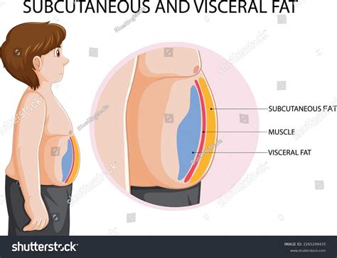 474 Belly Fat Diagram Images, Stock Photos & Vectors | Shutterstock