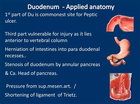 Anatomy of duodenum, duodenum structure, PPT of duodenum, power point presentation duodenum | PPTX