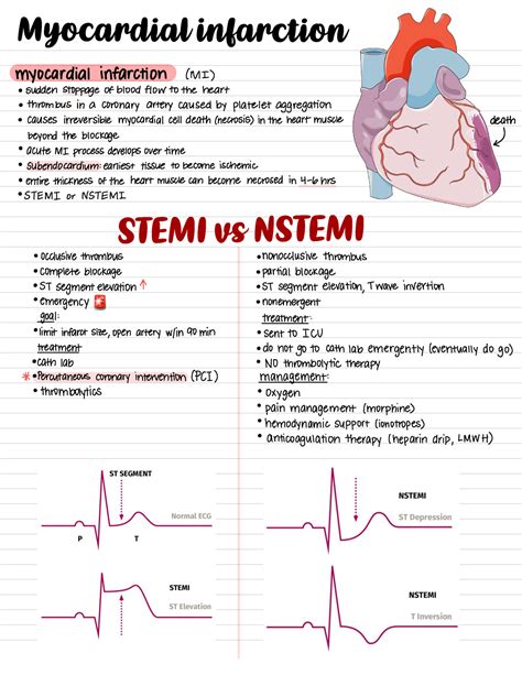MI, Stemi, Nstemi - 2432 - Studocu