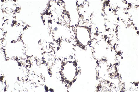 IHCeasy NXF1 Ready-To-Use IHC Kit KHC1976 | Proteintech