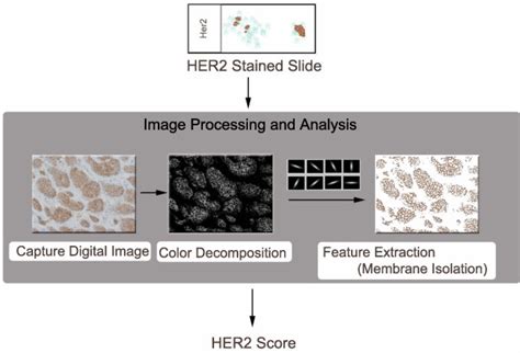 Image result for Computer Assistant Image Analysis ImageJ
