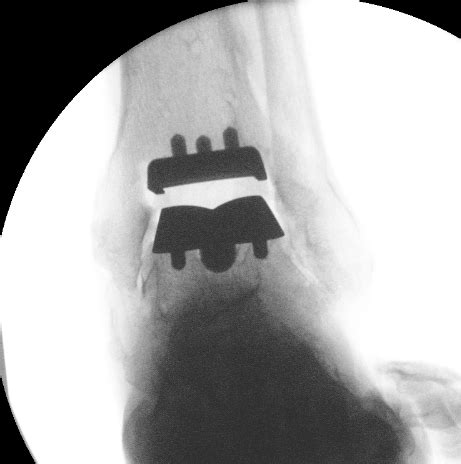 Hardware Monitor Driver 的图像结果