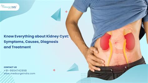 Kidney Cyst: Symptoms, Causes, Diagnosis, And Treatment
