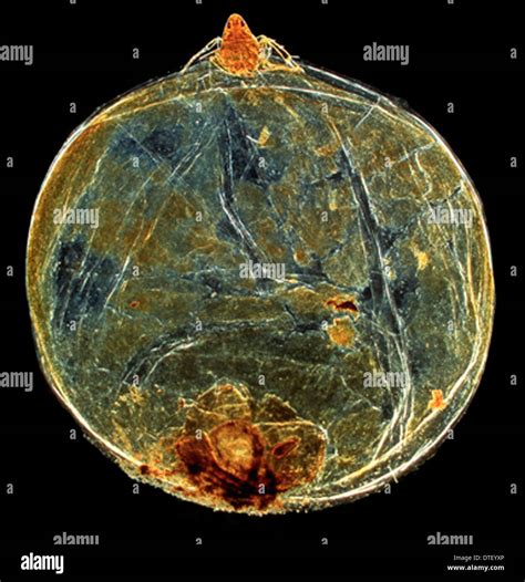 Jigger Fleas Remove 的图像结果