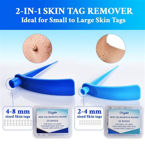 Buy D'Eyeko Upgraded Skin Tag Removal Kit for Small to Large (2mm to 8mm) Sized Skin Tags ...
