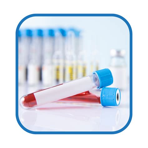 MMR Antibody Titer - NMS Health