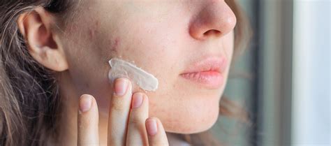 How much Salicylic Acid to use for acne - Re’equil – Re'equil