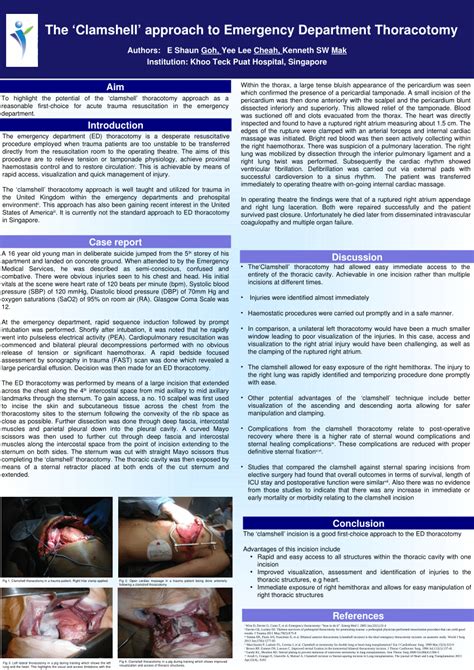 Image result for Clamshell Thoracotomy