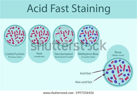 Image result for Acid-Fast Staining Method