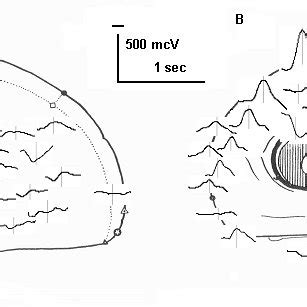 K-Complex 的图像结果